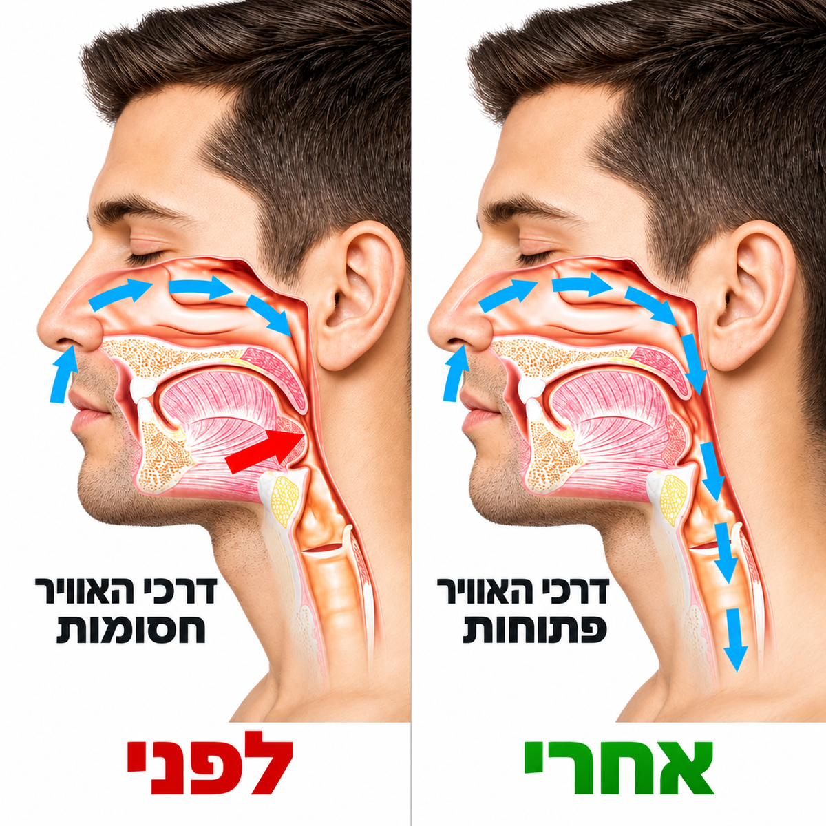 ספריי נגד נחירות - LUMA